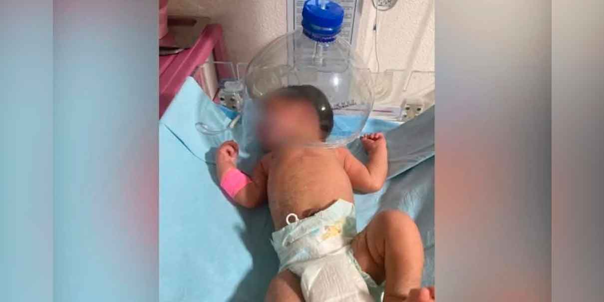   Improvisación médica ante carencia de equipo neonatal. Bebé es atendido con botella plástica