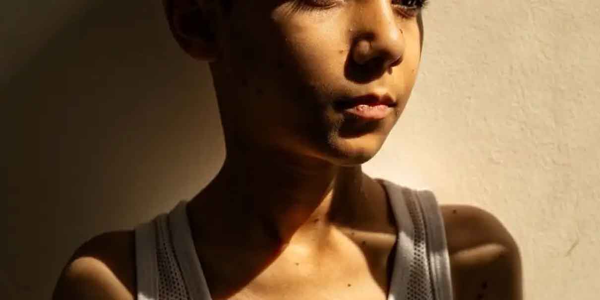 World Press Photo 2025: Imagen de niño herido en Gaza gana Foto del Año