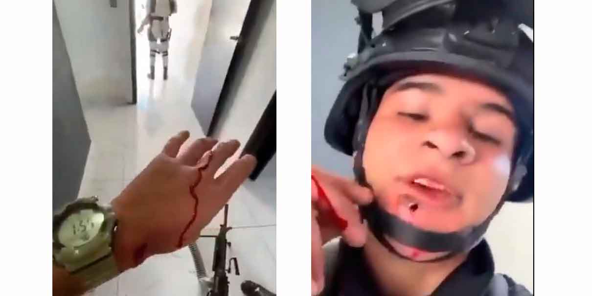 Soldado herido en Jalisco tras muerte de El Mencho: video muestra bala alojada en su rostro