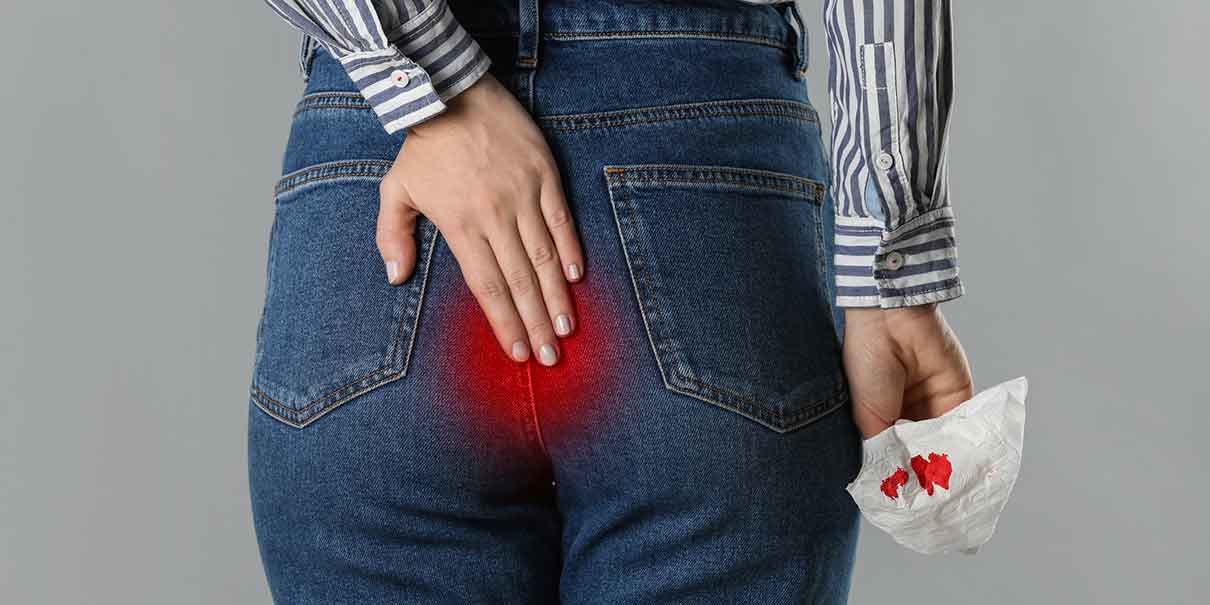 ¿Tienes hemorroides? Señales, causas y hábitos clave para evitarlas