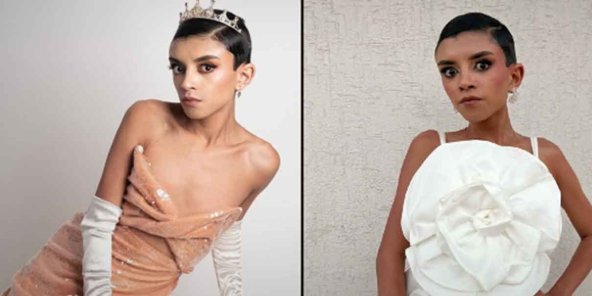 "La Venenito" planea aumento de busto a los 17 y le llueven críticas en redes sociales