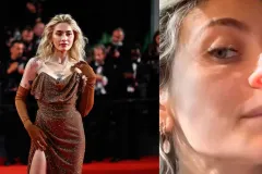 IMPACTANTE. Paris Jackson comparte en TikTok las secuelas físicas de su adicción