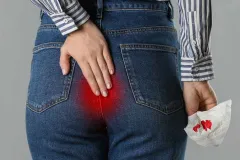 ¿Tienes hemorroides? Señales, causas y hábitos clave para evitarlas
