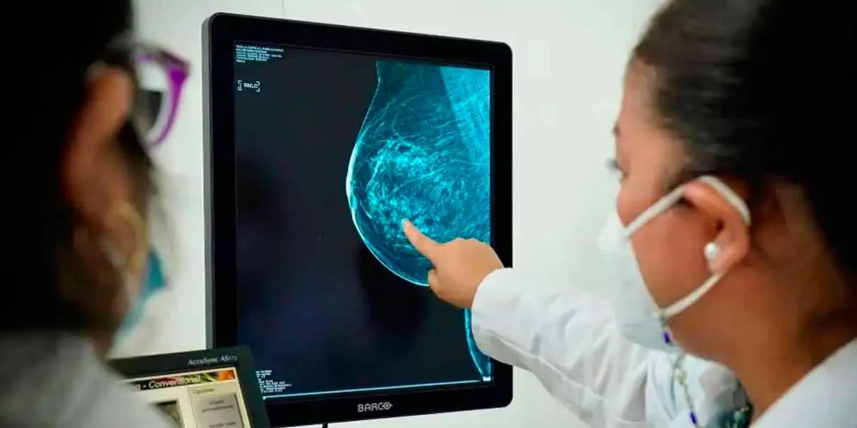 Pacientes con cáncer de mama deberían evitar estas dietas altas en grasa, advierten científicos