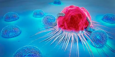 El estrés prolongado y su relación con el CÁNCER: ¿es un factor de riesgo?