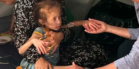 ONU confirma hambruna en Gaza y acusa a Israel de usar el hambre como arma de guerra