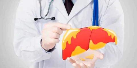 Cómo revertir el hígado graso con cinco consejos clave que además previenen diabetes y obesidad