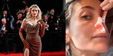 IMPACTANTE. Paris Jackson comparte en TikTok las secuelas físicas de su adicción
