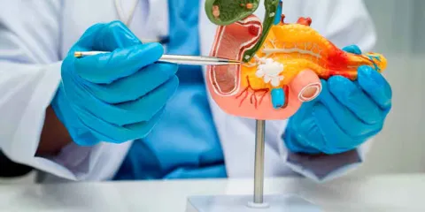 Avance histórico: científicos logran eliminar CÁNCER de páncreas en RATONES