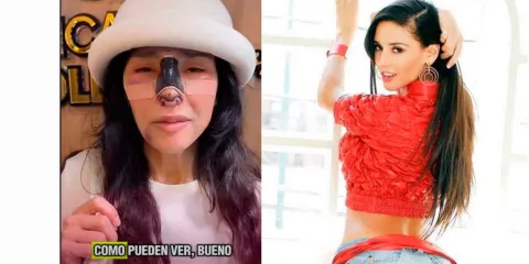 Dorismar reaparece tras someterse a una reconstrucción nasal luego de una cirugía estética fallida que afectó su respiración y la llevó a un proceso legal.