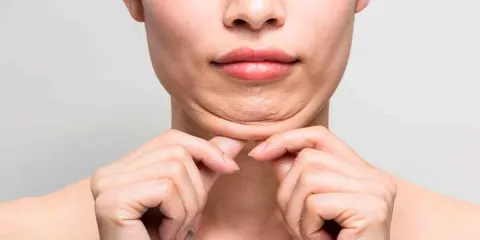 Adiós papada: la vitamina que combate el doble mentón y rejuvenece la piel