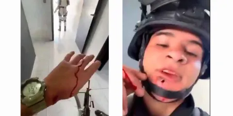 Soldado herido en Jalisco tras muerte de El Mencho: video muestra bala alojada en su rostro