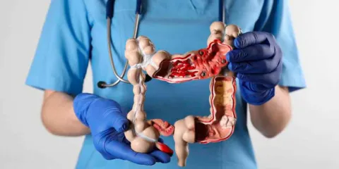 Cáncer de colon: Síntomas y señales de alerta que pueden salvar tu vida 