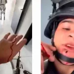 Soldado herido en Jalisco tras muerte de El Mencho: video muestra bala alojada en su rostro